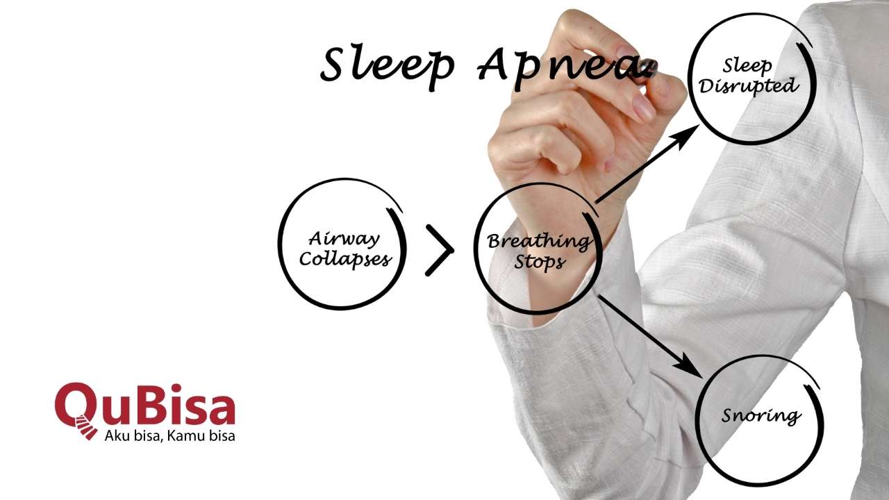 Kenali Bahaya Sleep Apnea Dan Cara Mencegahnya 4517